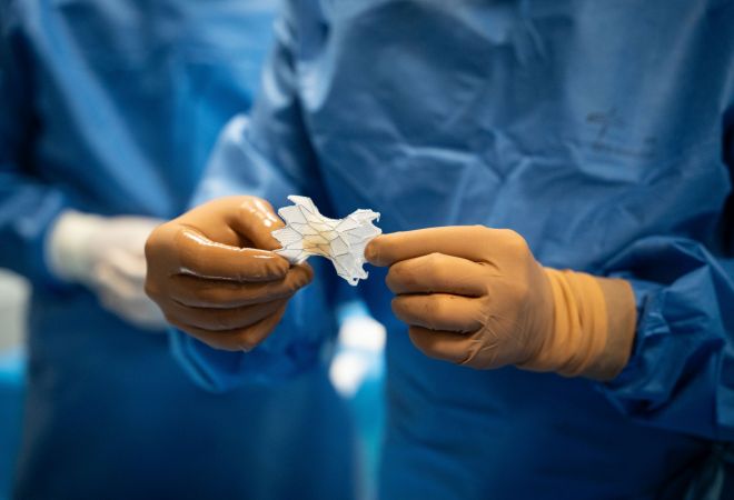 Zwei Hände in Handschuhen halten eine neue Pulmonalklappe während eines Kathetereingriffs.