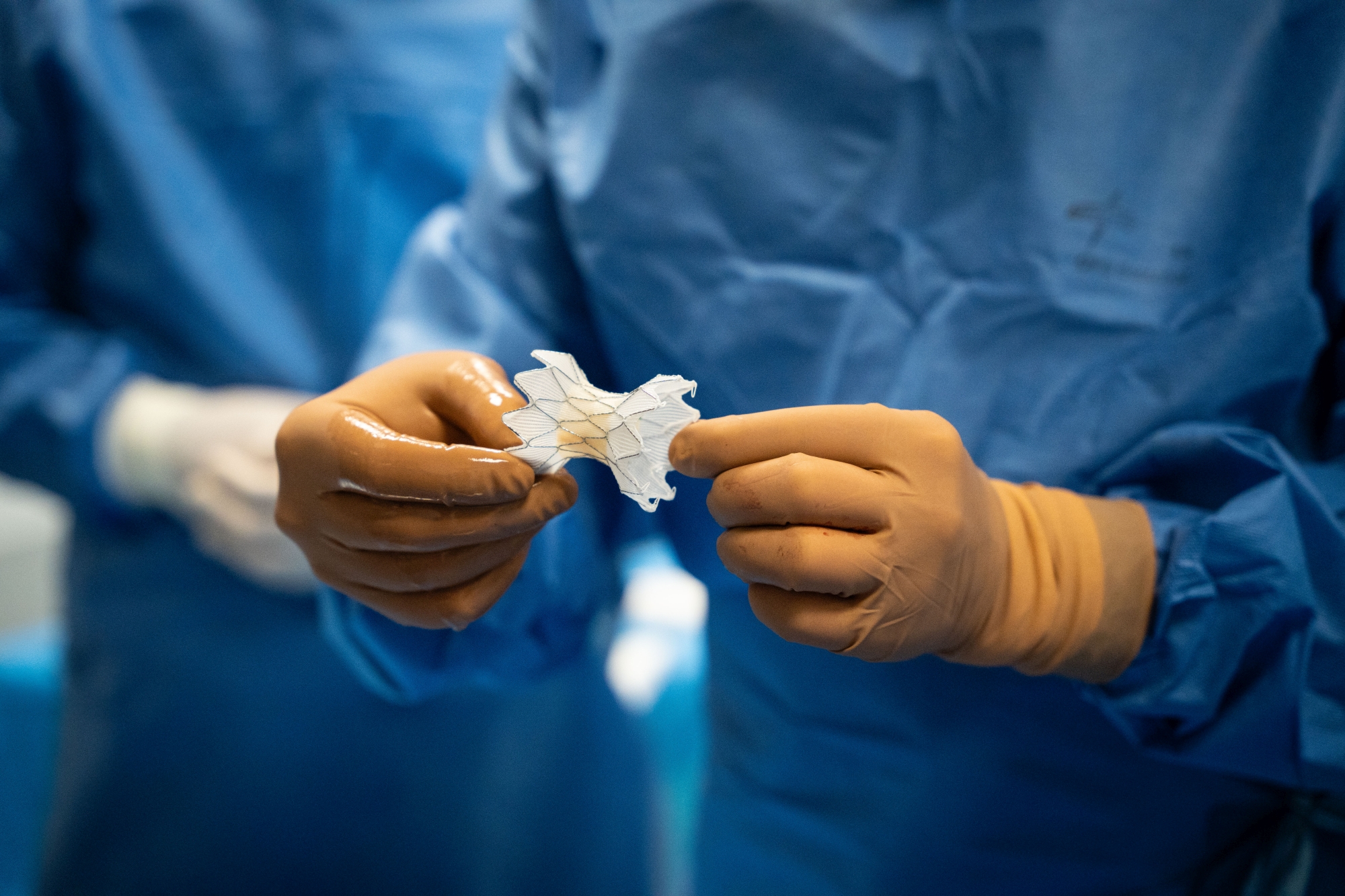 Zwei Hände in Handschuhen halten eine neue Pulmonalklappe während eines Kathetereingriffs.